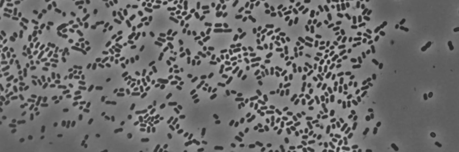 A. baumannii bacteria