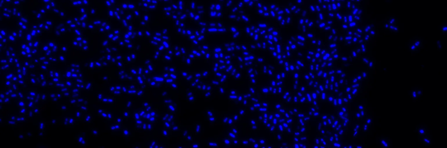 Bacterial DNA (DAPI)