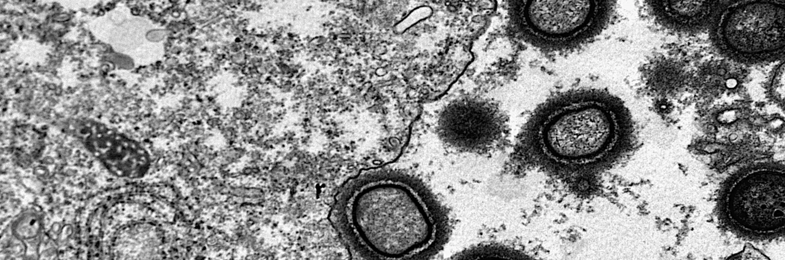 Host-pathogen interactions