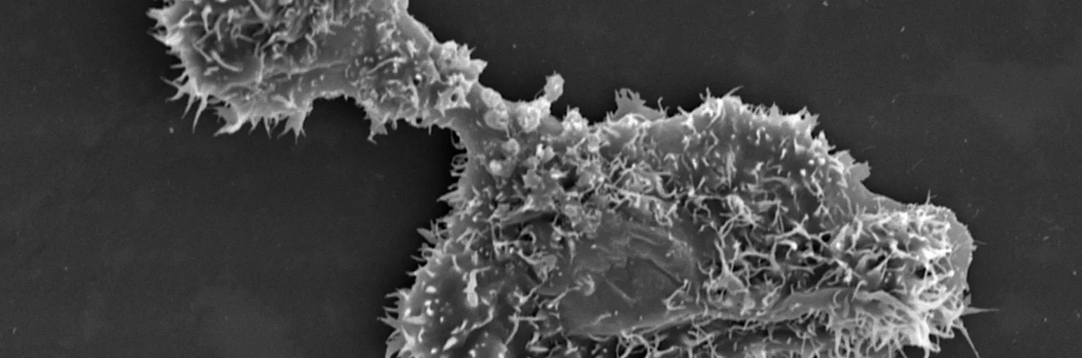 A. castellanii as infection model