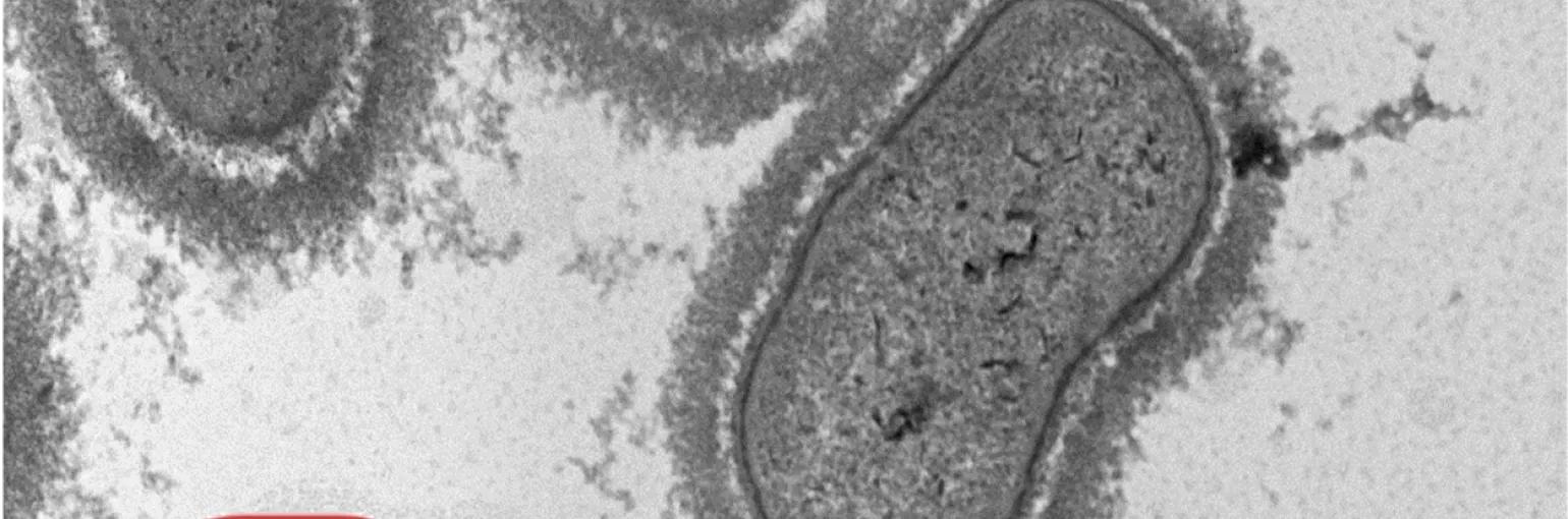 Capsulated bacteria